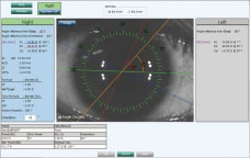 Nidek - AL - Scan Biometer